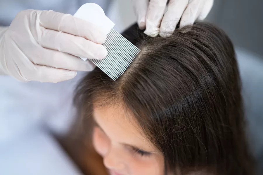 How to Check for Lice